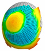 orbscan bilan laser