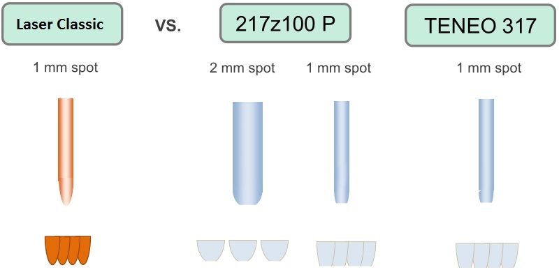Faisceau laser excimer en spots