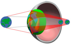 astigmate et hypermétrope
