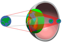 astigmate et myope